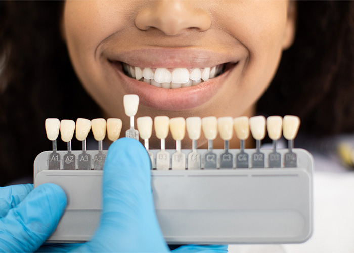 A patient with dental veneers